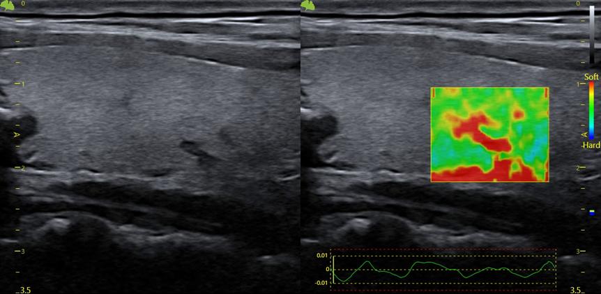Máy siêu âm 5D Vinno R500
